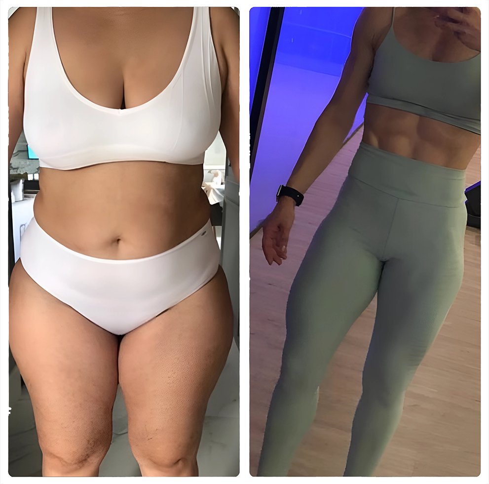 Resultado de paciente do curso Dieta Hormonal