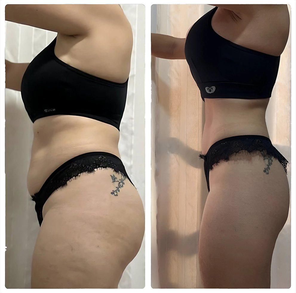 Resultado de paciente do curso Dieta Hormonal